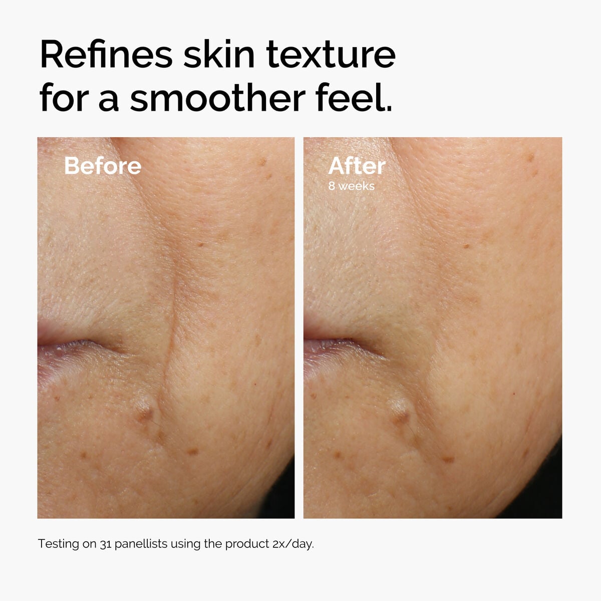 Caffeine + Escin Face Serum Targeted Serum Care X0