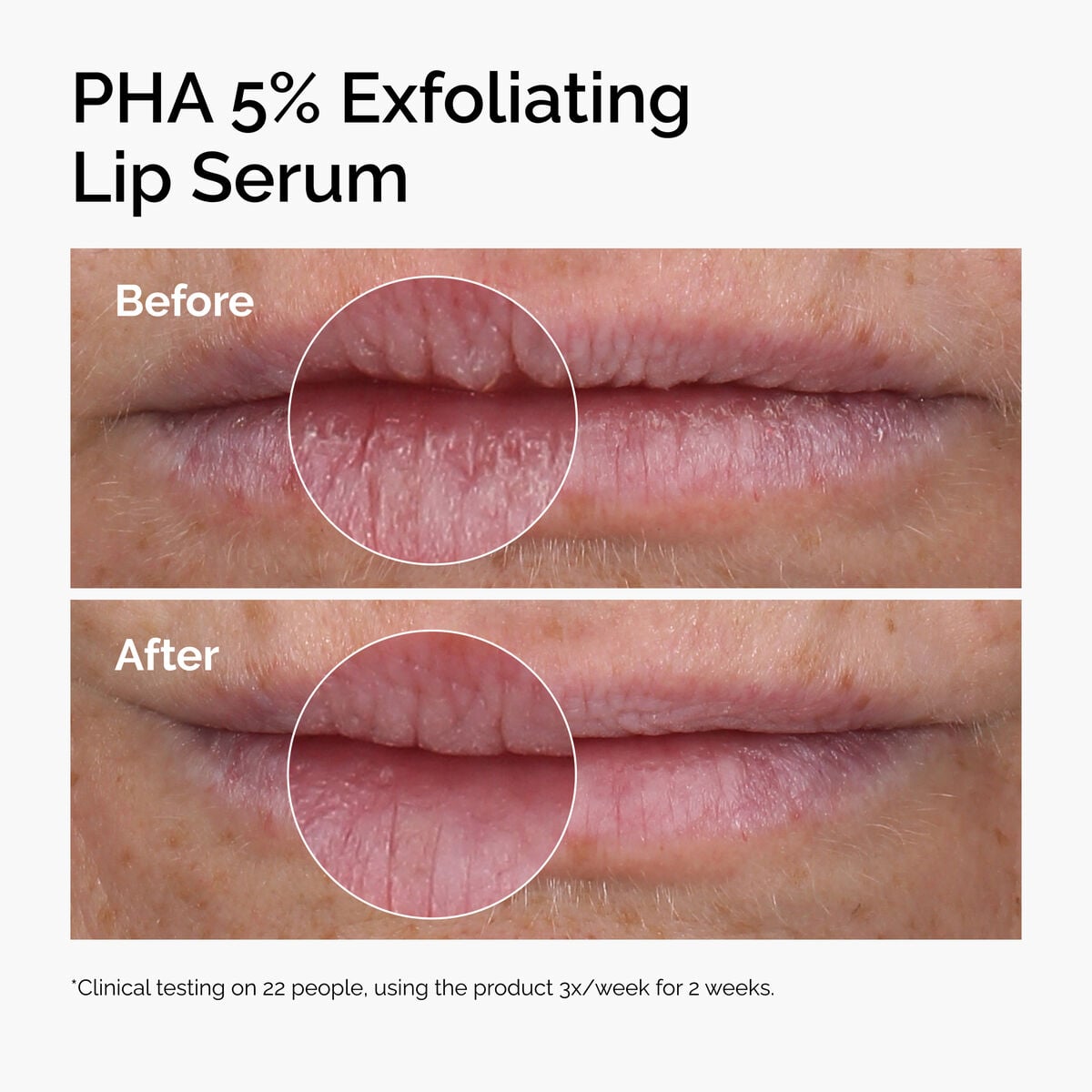 PHA Exfoliating Lip Serum Daily Treatment Ritual O8