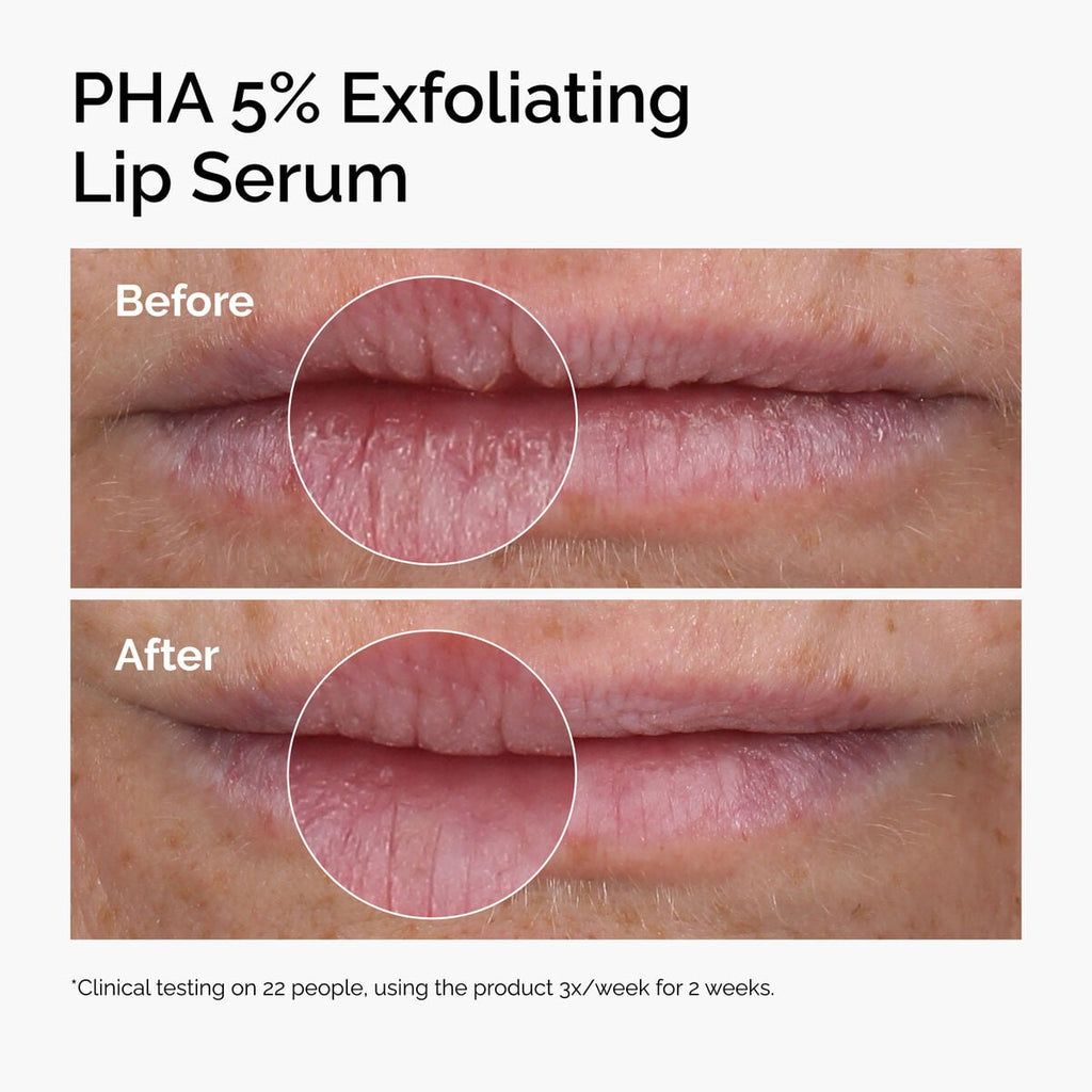 PHA Exfoliating Lip Serum Targeted Serum Care I2
