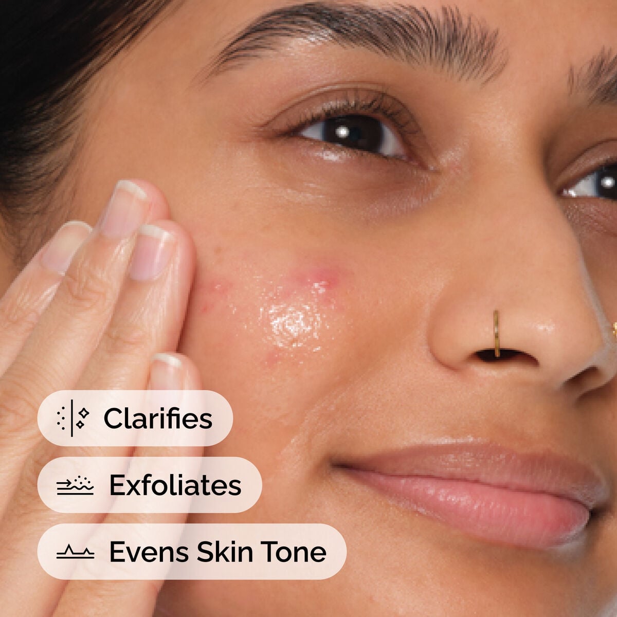 Salicylic Acid Anhydrous Solution Targeted Serum Care V2